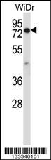 CCDC22 Antibody (C-term) (Cat. #AP13480b) western blot analysis in WiDr cell line lysates (35ug/lane).This demonstrates the CCDC22 antibody detected the CCDC22 protein (arrow).