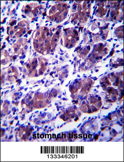 CCDC22 Antibody (C-term) (Cat. #AP13480b)immunohistochemistry analysis in formalin fixed and paraffin embedded human stomach tissue followed by peroxidase conjugation of the secondary antibody and DAB staining.This data demonstrates the use of CCDC22 Antibody (C-term) for immunohistochemistry. Clinical relevance has not been evaluated.