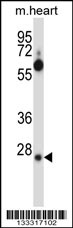 SFRS2B Antibody (N-term ) (Cat. #AP13474a) western blot analysis in mouse heart tissue lysates (35ug/lane).This demonstrates the SFRS2B antibody detected the SFRS2B protein (arrow).