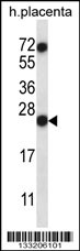 RNASE8 Antibody (C-term) (Cat. #AP13463b) western blot analysis in human placenta tissue lysates (35ug/lane).This demonstrates the RNASE8 antibody detected the RNASE8 protein (arrow).