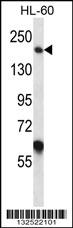 MYOM1 Antibody (Center) (Cat. #AP13444c) western blot analysis in HL-60 cell line lysates (35ug/lane).This demonstrates the MYOM1 antibody detected the MYOM1 protein (arrow).