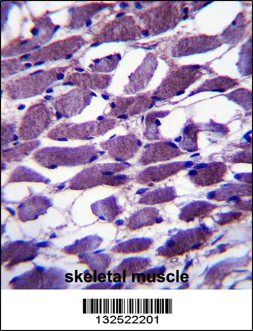 MYOM1 Antibody (Center) (Cat. #AP13444c)immunohistochemistry analysis in formalin fixed and paraffin embedded human skeletal muscle followed by peroxidase conjugation of the secondary antibody and DAB staining.This data demonstrates the use of MYOM1 Antibody (Center) for immunohistochemistry. Clinical relevance has not been evaluated.