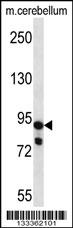 USP45 Antibody (Center) (Cat. #AP13409c) western blot analysis in mouse cerebellum tissue lysates (35ug/lane).This demonstrates the USP45 antibody detected the USP45 protein (arrow).