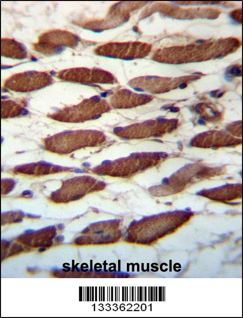 USP45 Antibody (Center) (Cat. #AP13409c)immunohistochemistry analysis in formalin fixed and paraffin embedded human skeletal muscle followed by peroxidase conjugation of the secondary antibody and DAB staining.This data demonstrates the use of USP45 Antibody (Center) for immunohistochemistry. Clinical relevance has not been evaluated.