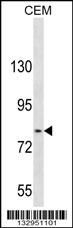 TGFBRAP1 Antibody (C-term) (Cat. #AP13395b) western blot analysis in CEM cell line lysates (35ug/lane).This demonstrates the TGFBRAP1 antibody detected the TGFBRAP1 protein (arrow).