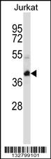 KCTD10 Antibody (C-term) (Cat. #AP13390b) western blot analysis in Jurkat cell line lysates (35ug/lane).This demonstrates the KCTD10 antibody detected the KCTD10 protein (arrow).