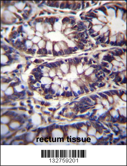 TTC15 Antibody (C-term) (Cat. #AP13387b)immunohistochemistry analysis in formalin fixed and paraffin embedded human rectum tissue followed by peroxidase conjugation of the secondary antibody and DAB staining.This data demonstrates the use of TTC15 Antibody (C-term) for immunohistochemistry. Clinical relevance has not been evaluated.