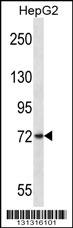 FRMD7 Antibody (N-term) (Cat. #AP13371a) western blot analysis in HepG2 cell line lysates (35ug/lane).This demonstrates the FRMD7 antibody detected the FRMD7 protein (arrow).