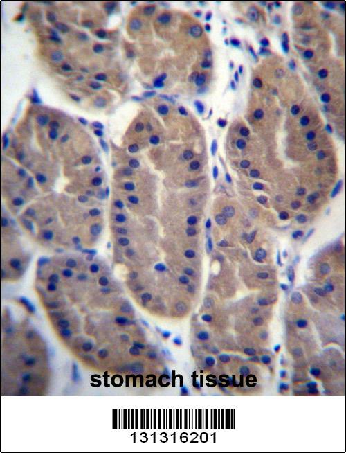 FRMD7 Antibody (N-term) (Cat. #AP13371a)immunohistochemistry analysis in formalin fixed and paraffin embedded human stomach tissue followed by peroxidase conjugation of the secondary antibody and DAB staining.This data demonstrates the use of FRMD7 Antibody (N-term) for immunohistochemistry. Clinical relevance has not been evaluated.
