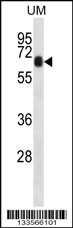 CCDC120 Antibody (N-term) (Cat. #AP13363a) western blot analysis in uterus tumor cell line lysates (35ug/lane).This demonstrates the CCDC120 antibody detected the CCDC120 protein (arrow).