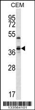 WDR25 Antibody (C-term) (Cat. #AP13361b) western blot analysis in CEM cell line lysates (35ug/lane).This demonstrates the WDR25 antibody detected the WDR25 protein (arrow).