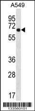 WSCD2 Antibody (C-term) (Cat. #AP13359b) western blot analysis in A549 cell line lysates (35ug/lane).This demonstrates the WSCD2 antibody detected the WSCD2 protein (arrow).