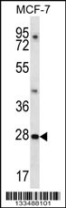 PDCL3 Antibody (N-term) (Cat. #AP13347a) western blot analysis in MCF-7 cell line lysates (35ug/lane).This demonstrates the PDCL3 antibody detected the PDCL3 protein (arrow).