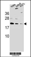 ARL6IP6Antibody(N-term) (Cat. #AP13337a) western blot analysis in A375,Hela,Jurkat cell line lysates (35ug/lane).This demonstrates the ARL6IP6 antibody detected the ARL6IP6 protein (arrow).