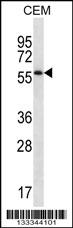 MOSPD2 Antibody (N-term ) (Cat. #AP13323a) western blot analysis in CEM cell line lysates (35ug/lane).This demonstrates the MOSPD2 antibody detected the MOSPD2 protein (arrow).