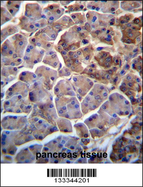 MOSPD2 Antibody (N-term) (Cat. #AP13323a)immunohistochemistry analysis in formalin fixed and paraffin embedded human pancreas tissue followed by peroxidase conjugation of the secondary antibody and DAB staining.This data demonstrates the use of MOSPD2 Antibody (N-term) for immunohistochemistry. Clinical relevance has not been evaluated.
