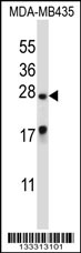 MEA1 Antibody (N-term ) (Cat. #AP13315a) western blot analysis in MDA-MB435 cell line lysates (35ug/lane).This demonstrates the MEA1 antibody detected the MEA1 protein (arrow).