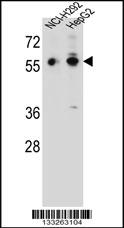 TRIM64 Antibody (C-term) (Cat. #AP13294b) western blot analysis in NCI-H292,HepG2 cell line lysates (35ug/lane).This demonstrates the TRIM64 antibody detected the TRIM64 protein (arrow).