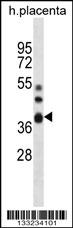 NT5C3L Antibody (N-term) (Cat. #AP13283a) western blot analysis in human placenta tissue lysates (35ug/lane).This demonstrates the NT5C3L antibody detected the NT5C3L protein (arrow).