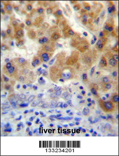 NT5C3L Antibody (N-term) (Cat. #AP13283a)immunohistochemistry analysis in formalin fixed and paraffin embedded human liver tissue followed by peroxidase conjugation of the secondary antibody and DAB staining.This data demonstrates the use of NT5C3L Antibody (N-term) for immunohistochemistry. Clinical relevance has not been evaluated.