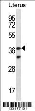 OR4X2 Antibody (C-term) (Cat. #AP13266b) western blot analysis in human normal Uterus tissue lysates (35ug/lane).This demonstrates the OR4X2 antibody detected the OR4X2 protein (arrow).