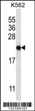 CHAC2 Antibody (Center) (Cat. #AP13260c) western blot analysis in K562 cell line lysates (35ug/lane).This demonstrates the CHAC2 antibody detected the CHAC2 protein (arrow).