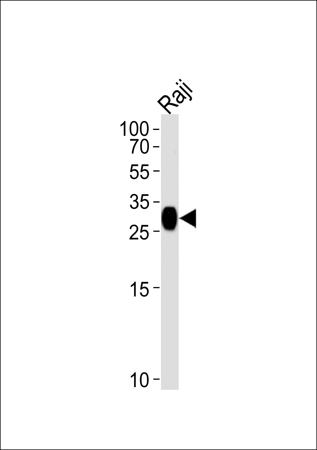 Western blot analysis of lysate from Raji cell line, using HLA-DRB4 Antibody (N-term)(Cat. #AP13690a). AP13690a was diluted at 1:1000 at each lane. A goat anti-rabbit IgG H&L(HRP) at 1:5000 dilution was used as the secondary antibody. Lysate at 35ug per lane.