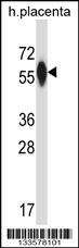 P4HA3 Antibody (Center) (Cat. #AP13685c) western blot analysis in human placenta tissue lysates (35ug/lane).This demonstrates the P4HA3 antibody detected the P4HA3 protein (arrow).