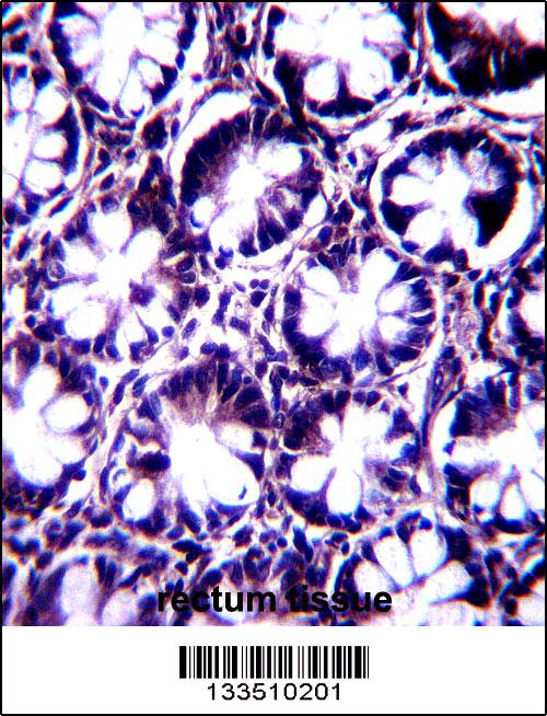 KIAA1274 Antibody (C-term) (Cat. #AP13680b)immunohistochemistry analysis in formalin fixed and paraffin embedded human rectum tissue followed by peroxidase conjugation of the secondary antibody and DAB staining.This data demonstrates the use of KIAA1274 Antibody (C-term) for immunohistochemistry. Clinical relevance has not been evaluated.