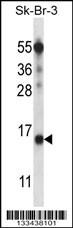 BTF3L4 Antibody (C-term) (Cat. #AP13668b) western blot analysis in SK-BR-3 cell line lysates (35ug/lane).This demonstrates the BTF3L4 antibody detected the BTF3L4 protein (arrow).