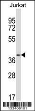 PAQR6 Antibody (C-term) (Cat. #AP13667b) western blot analysis in Jurkat cell line lysates (35ug/lane).This demonstrates the PAQR6 antibody detected the PAQR6 protein (arrow).
