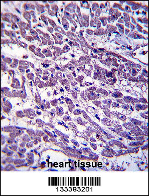 EMILIN3 Antibody (C-term) (Cat. #AP13662b)immunohistochemistry analysis in formalin fixed and paraffin embedded human heart tissue followed by peroxidase conjugation of the secondary antibody and DAB staining.This data demonstrates the use of EMILIN3 Antibody (C-term) for immunohistochemistry. Clinical relevance has not been evaluated.