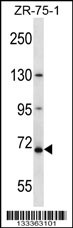 ZNF135 Antibody (N-term ) (Cat. #AP13659a) western blot analysis in ZR-75-1 cell line lysates (35ug/lane).This demonstrates the ZNF135 antibody detected the ZNF135 protein (arrow).