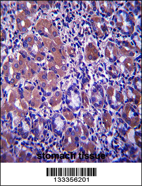 B4GALNT3 Antibody (Center) (Cat. #AP13658c)immunohistochemistry analysis in formalin fixed and paraffin embedded human stomach tissue followed by peroxidase conjugation of the secondary antibody and DAB staining.This data demonstrates the use of B4GALNT3 Antibody (Center) for immunohistochemistry. Clinical relevance has not been evaluated.