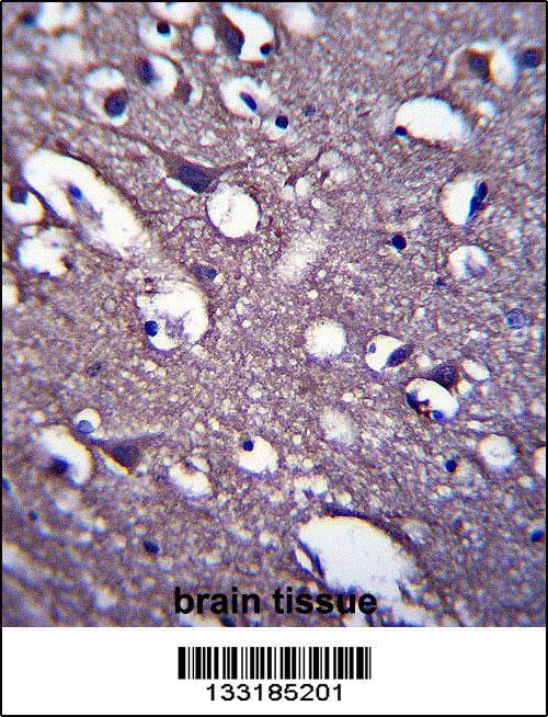 PRR18 Antibody (C-term) (Cat. #AP13631b)immunohistochemistry analysis in formalin fixed and paraffin embedded human brain tissue followed by peroxidase conjugation of the secondary antibody and DAB staining.This data demonstrates the use of PRR18 Antibody (C-term) for immunohistochemistry. Clinical relevance has not been evaluated.