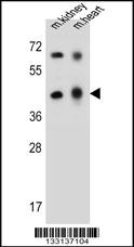 ADAL Antibody (C-term) (Cat. #AP13621b) western blot analysis in mouse kidney,heart tissue lysates (35ug/lane).This demonstrates the ADAL antibody detected the ADAL protein (arrow).