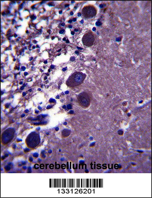 KCNK18 Antibody (Center) (Cat. #AP13619c)immunohistochemistry analysis in formalin fixed and paraffin embedded human cerebellum tissue followed by peroxidase conjugation of the secondary antibody and DAB staining.This data demonstrates the use of KCNK18 Antibody (Center) for immunohistochemistry. Clinical relevance has not been evaluated.