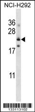 FOLR3 Antibody (N-term) (Cat. #AP13617a) western blot analysis in NCI-H292 cell line lysates (35ug/lane).This demonstrates the FOLR3 antibody detected the FOLR3 protein (arrow).