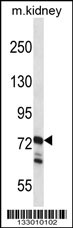 RGL1 Antibody (Center) (Cat. #AP13609c) western blot analysis in mouse kidney tissue lysates (35ug/lane).This demonstrates the RGL1 antibody detected the RGL1 protein (arrow).