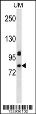 PDZD4 Antibody (N-term) (Cat. #AP13603a) western blot analysis in uterine tumor cell line lysates (35ug/lane).This demonstrates the PDZD4 antibody detected the PDZD4 protein (arrow).