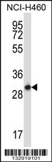 STX17 Antibody (N-term) (Cat. #AP13599a) western blot analysis in NCI-H460 cell line lysates (35ug/lane).This demonstrates the STX17 antibody detected the STX17 protein (arrow).