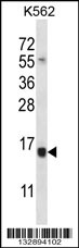 SELK Antibody (Center) (Cat. #AP13595c) western blot analysis in K562 cell line lysates (35ug/lane).This demonstrates the SELK antibody detected the SELK protein (arrow).