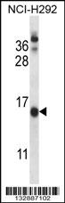 CNIH Antibody (C-term) (Cat. #AP13594b) western blot analysis in NCI-H292 cell line lysates (35ug/lane).This demonstrates the CNIH antibody detected the CNIH protein (arrow).