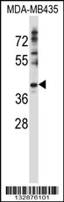 DNAJC28 Antibody (C-term) (Cat. #AP13593b) western blot analysis in MDA-MB435 cell line lysates (35ug/lane).This demonstrates the DNAJC28 antibody detected the DNAJC28 protein (arrow).