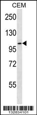 RHBDF2 Antibody (N-term) (Cat. #AP13588a) western blot analysis in CEM cell line lysates (35ug/lane).This demonstrates the RHBDF2 antibody detected the RHBDF2 protein (arrow).