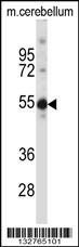 TSPYL5 Antibody (C-term) (Cat. #AP13583b) western blot analysis in mouse cerebellum tissue lysates (35ug/lane).This demonstrates the TSPYL5 antibody detected the TSPYL5 protein (arrow).