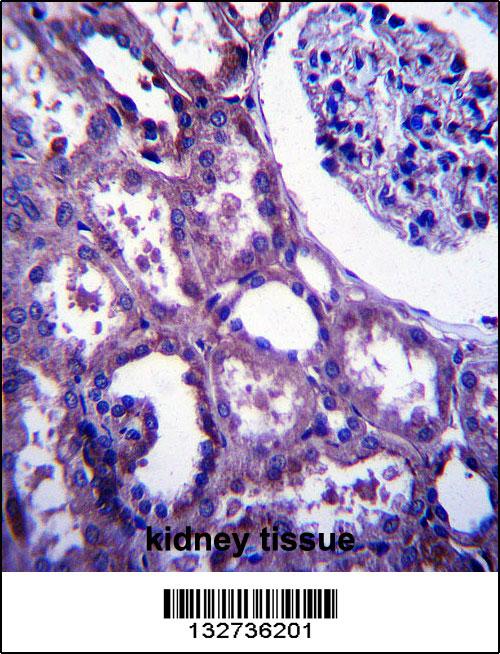 EMP2 Antibody (C-term) (Cat. #AP13581b)immunohistochemistry analysis in formalin fixed and paraffin embedded human kidney tissue followed by peroxidase conjugation of the secondary antibody and DAB staining.This data demonstrates the use of EMP2 Antibody (C-term) for immunohistochemistry. Clinical relevance has not been evaluated.