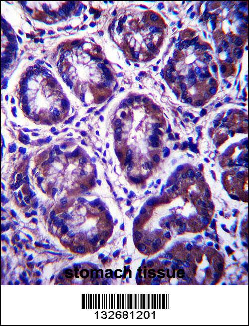 RIBC2 Antibody (N-term) (Cat. #AP13580a)immunohistochemistry analysis in formalin fixed and paraffin embedded human stomach tissue followed by peroxidase conjugation of the secondary antibody and DAB staining.This data demonstrates the use of RIBC2 Antibody (N-term) for immunohistochemistry. Clinical relevance has not been evaluated.