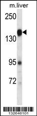 PLXNC1 Antibody (C-term) (Cat. #AP13576b) western blot analysis in mouse liver tissue lysates (35ug/lane).This demonstrates the PLXNC1 antibody detected the PLXNC1 protein (arrow).