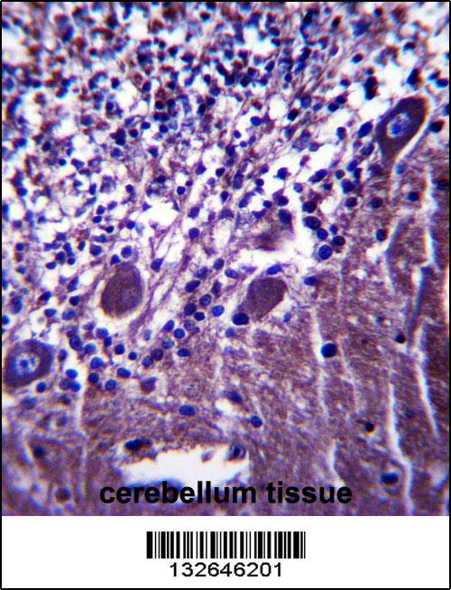 PLXNC1 Antibody (C-term) (Cat. #AP13576b)immunohistochemistry analysis in formalin fixed and paraffin embedded human cerebellum tissue followed by peroxidase conjugation of the secondary antibody and DAB staining.This data demonstrates the use of PLXNC1 Antibody (C-term) for immunohistochemistry. Clinical relevance has not been evaluated.